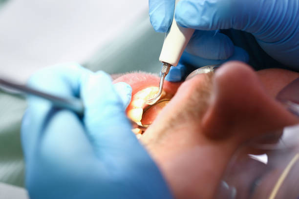 Best Emergency Cosmetic Dentistry in St Paul, MO